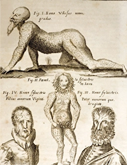 1662 Schott Orangutan, hypertrichosis 1662 Schott Orangutan, hypertrichosis