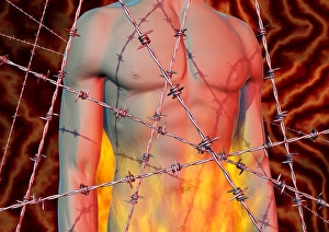 Abdominal Pain Prints: Abominal pain