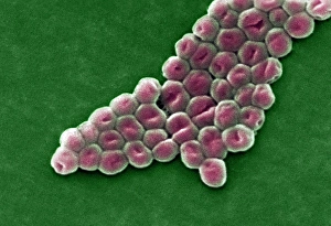 Acinetobacter baumannii bacteria, SEM Acinetobacter baumannii bacteria, SEM