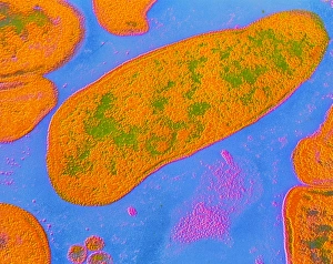 Gram Negative Bacteria Prints: Acinetobacter sp. bacteria