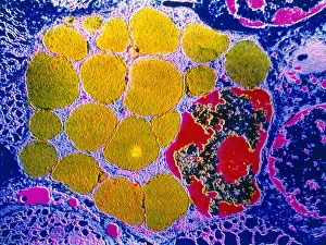 Antibody Production Process Prints: Activated plasma cell, TEM