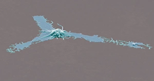 Prints of Activated platelet. Coloured scanning electron micrograph (SEM) of an activated platelet, or thrombocyte, from peripheral blood. Magnification: x2, 500 when printed at 10 centimetres wide Images Dated 2011 September: Activated Platelet Print, SEM