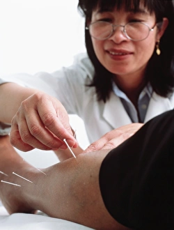 Acupuncture Print: Acupuncturist inserting needles into a patient's legs