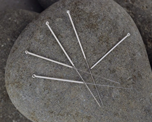 Acupuncture Treatment Prints: Acupuncture needles