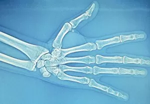 Images Dated 17th February 2004: Adult hand X-ray
