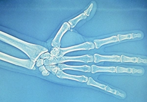 Adult hand X-ray Adult hand X-ray