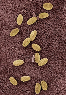 Allergens in trachea Allergens in trachea
