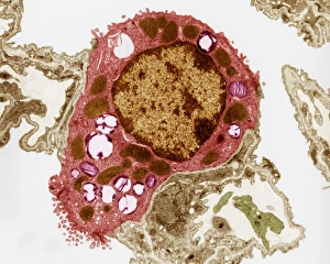 Transmission Electron Micrograph Prints: Alveolar cell, TEM