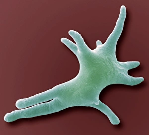 Scanning Electron Microscope Images Prints: Amoeba, SEM