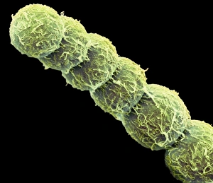 Images Dated 1st November 2012: SEM Print of Anabaena Algae Filaments