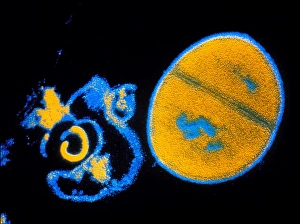 Bacteria Under Microscope Prints: Antibiotic action on Staphylococcus