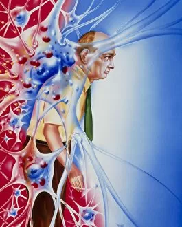 Images Dated 21st May 2003: Artwork depicting Parkinsons disease