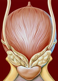 Artwork of enlarged bladder in urinary retention Artwork of enlarged bladder in urinary retention