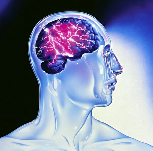 Prints of Epilepsy. Artwork depicting an epileptic attack (or seizure) as lightning in the brain of a model head Images Dated 2003 February: Epilepsy Brain Model Print