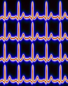 Artwork of healthy ECG traces of the heart Artwork of healthy ECG traces of the heart