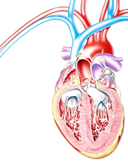 Artwork of heart in congestive heart failure Artwork of heart in congestive heart failure