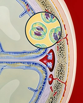Artwork of meninges & bacteria showing meningitis Artwork of meninges & bacteria showing Artwork of meninges & bacteria showing meningitis Artwork of meninges & bacteria showing
