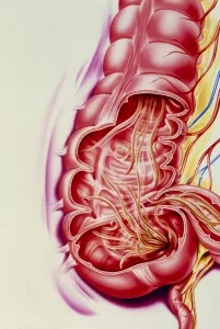 Artwork of nematode worms Ascaris sp. in intestine Artwork of nematode worms Ascaris sp. in intestine