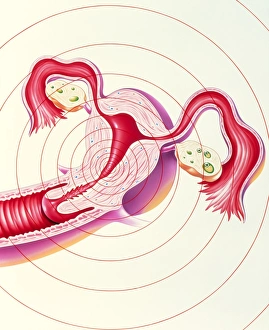 Artwork of uterus suffering menstrual pain Artwork of uterus suffering menstrual pain