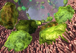 Prints of Asthma. Computer artwork of allergens (green) in the airways of the lungs. Allergens, such as dust and pollen, can trigger an asthma attack Images Dated 2008 March: Asthma Print: Computer artwork of allergens in the lungs' airways