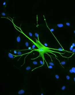Prints of Astrocyte nerve cell. Fluorescent light microscope of an astrocyte cell from a human brain Images Dated 2006 April: Astrocyte Nerve Cell Print