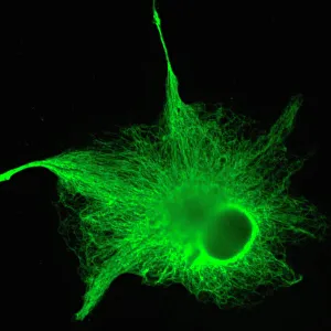 Prints of Astrocyte nerve cell. Fluorescent light micrograph of an astrocyte cell from a human brain Images Dated 2006 April: Human Brain Astrocyte Cell Print