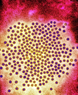 Transmission Electron Micrograph Prints: Astrovirus particles, TEM