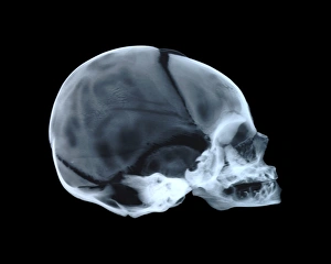Prints of Babys skull. Side view X-ray showing the cranium, eye socket, nasal area and mouth. For an X-ray of an adult human skull see image P120/222 and for an X-ray of a childs skull see image P120/224 Images Dated 2006 November: Baby's Skull Print: Side View X-ray Image