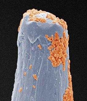 Images Dated 25th June 2004: SEM print of bacteria on a pin, coloured scanning electron micrograph