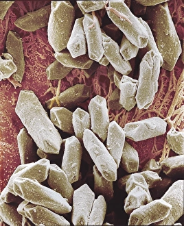 Print of Balancing Stone from Inner Ear, SEM