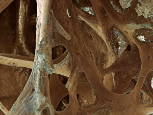 Prints of Bird bone. Coloured scanning electron micrograph (SEM) of the interior of bone from a birds skull. This porous structure found inside bone is called cancellous (spongy) bone Images Dated 2005 May: Bird bone Print, SEM