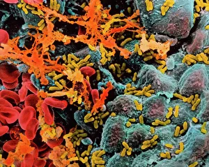 Images Dated 1994: Bacterial Infection of the Bladder Print