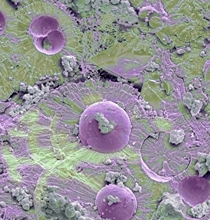 SEM Bladder Stone Print, a fractured crystalline mass