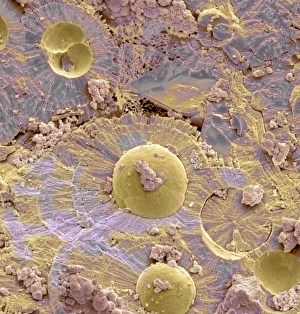 SEM Bladder Stone Print: A fractured crystalline mass