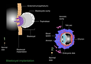 Blastocyst implantation, diagram Blastocyst implantation, diagram