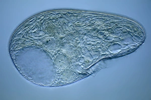 Light Microscopy Images Prints: Blepharisma protozoan, light micrograph