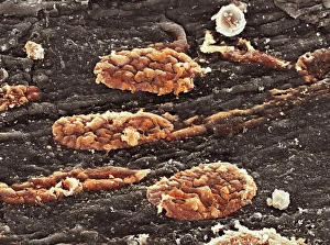 Prints of Blood clots. Coloured scanning electron micrograph (SEM) of small blood clots (red) in a blood vessel Images Dated 2008 July: SEM Blood Clot Print
