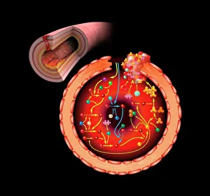 Blood coagulation cascade, artwork C016/9873 Blood coagulation cascade, artwork C016/9873