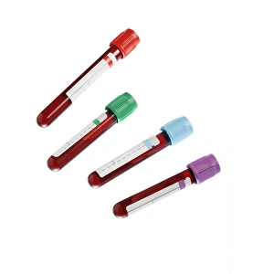 Medical Laboratory Equipment Prints: Blood samples