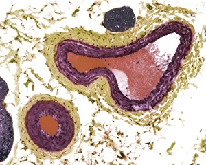 Blood Vessel Anatomy Prints: Blood vessels, light micrograph