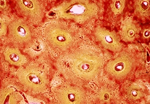 Human Bone Anatomy Prints: Bone canals, light micrograph