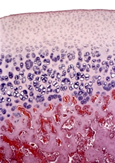 Prints of Bone growth. Light micrograph of actively growing cells in the epiphyseal plate (growth plate) between the diaphysis (shaft) and epiphysis (rounded end) of a long bone Images Dated 2007 December: Bone growth, light micrograph Print