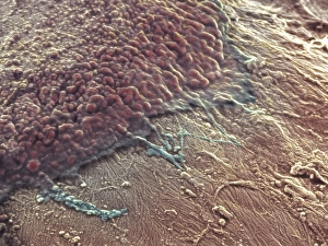 Coloured SEM Images Prints: Bone reabsorption, SEM
