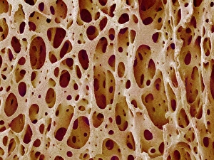 Images Dated 7th September 2004: Cancellous Bone Tissue Print