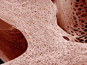 SEM Print of Cancellous Bone Tissue