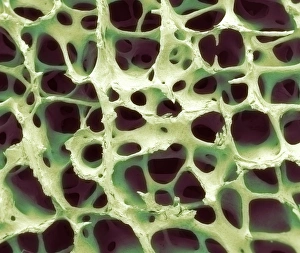 Images Dated 7th March 2013: Cancellous Bone Tissue Print