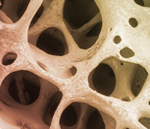Cancellous Bone Structure Prints: Bone tissue, SEM C013 / 4768