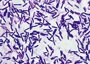 Botulism bacteria Botulism bacteria
