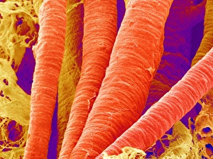 Blood Circulation System Prints: Brain arteries, SEM
