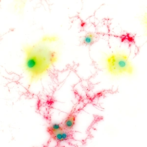 Brain Cell Structure Prints: Brain cells, light micrograph